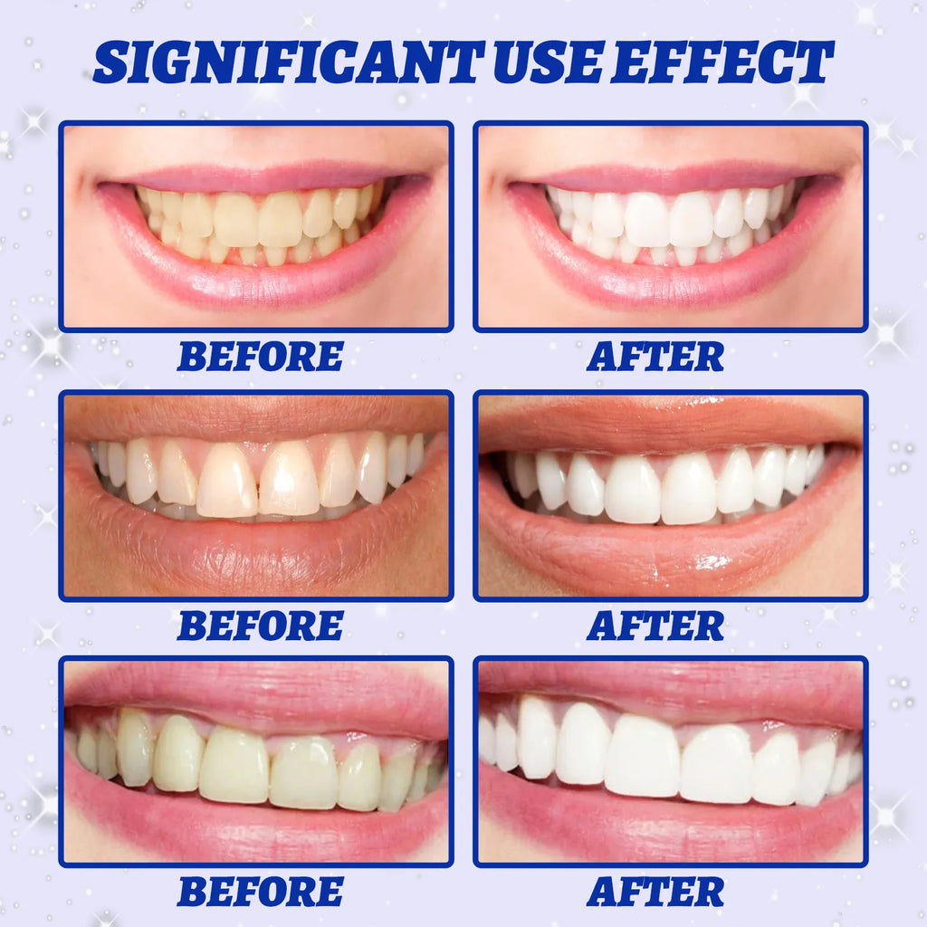 5D Teeth Whitening Strips Gel Remove Plaque Stains Cleaning Oral Hygiene Bleaching Dental Tools Fresh Breath Brighten Tooth Care