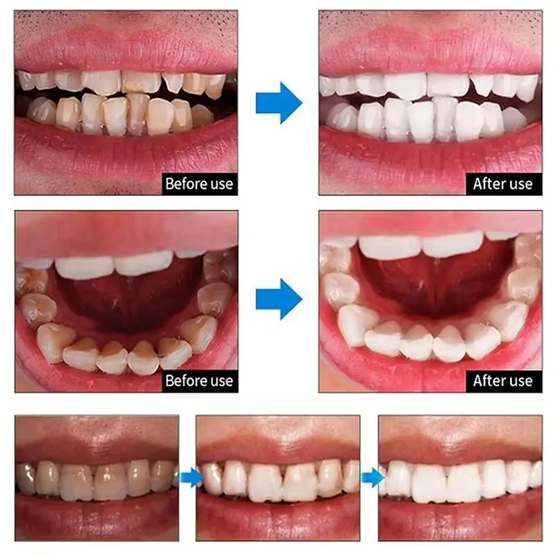 5D Teeth Whitening Strips Gel Remove Plaque Stains Cleaning Oral Hygiene Bleaching Dental Tools Fresh Breath Brighten Tooth Care