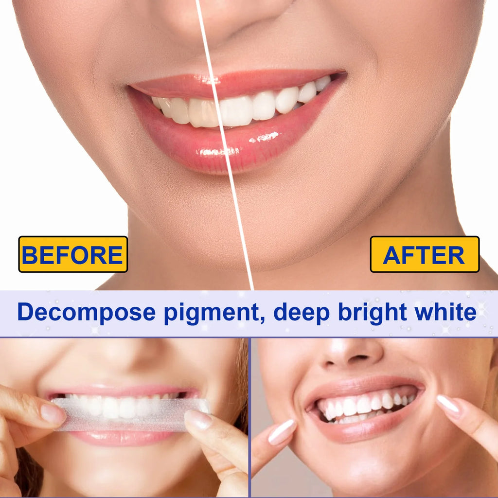 5D Teeth Whitening Strips Gel Remove Plaque Stains Cleaning Oral Hygiene Bleaching Dental Tools Fresh Breath Brighten Tooth Care